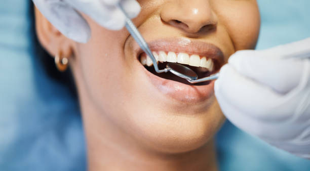 Best Emergency Dental Extractions in Hondo, TX