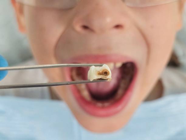 Best Holiday Emergency Dentist in Hondo, TX